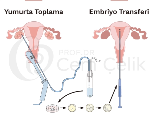 Embriyo Transferi