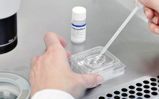 Embryo Glue