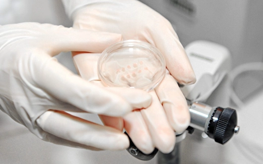 Preimplantation Genetic Diagnosis (PGD)