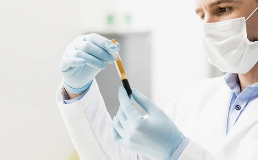 PRP Egg Quality Improvement
