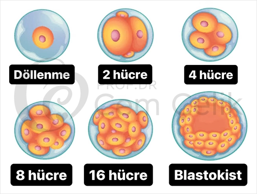 Tüp Bebek Döllenme Blastokist