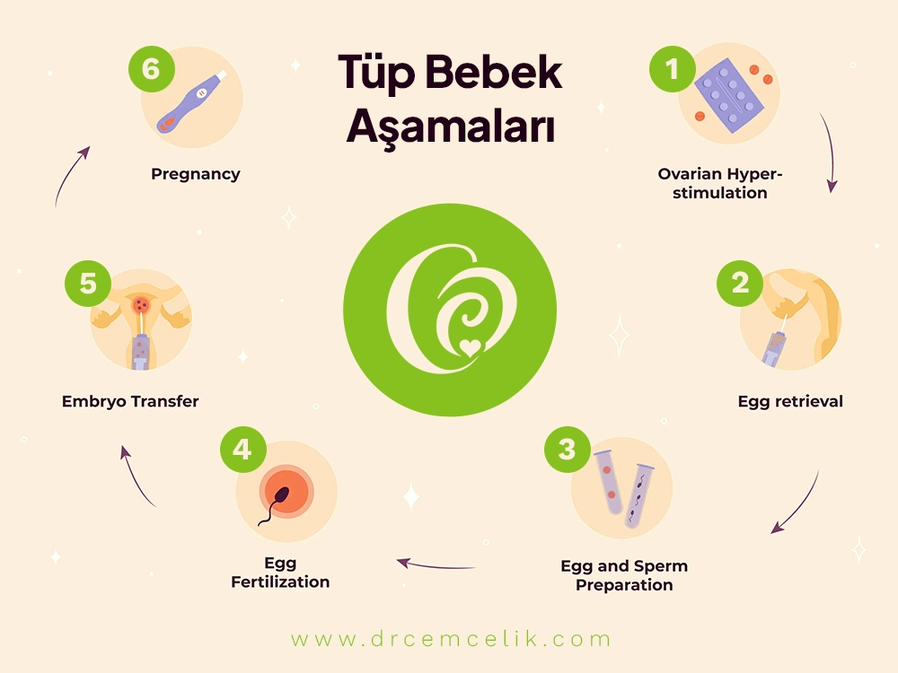 Tüp Bebek Tedavisi Aşamaları